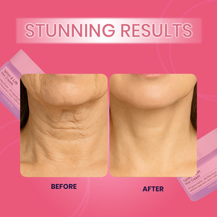 Neck Cream