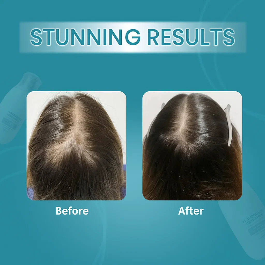 Zephta H - Regrow 2.0