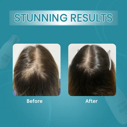 Zephta H - Regrow 2.0